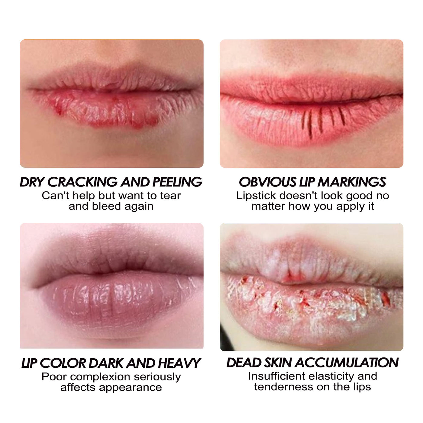 Moisturizing Lip Balm, Lighten Lip Lines, Prevent Dry Cracks, Peel, Remove Dead Skin, Volumizing Lip Lip Balm