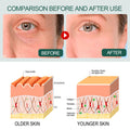OUHOE Essence collagen replenishing essence whitening freckle removal facial...